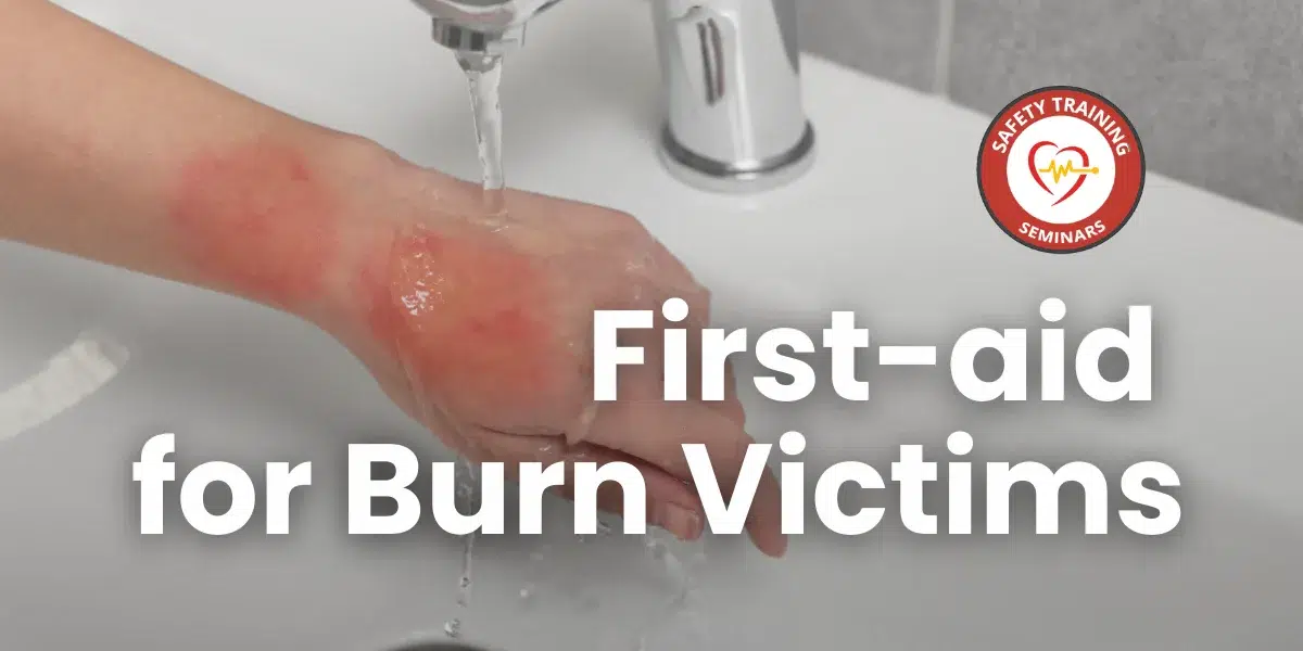 How to Care for a Burn Victim