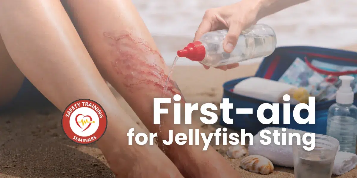 First Aid for Jellyfish Encounters